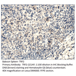 Anti-TRF2 Antibody from FabGennix (TRF2-221AP) - Antibodies.com