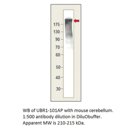 Anti-UBR1 Antibody from FabGennix (UBR1-101AP) - Antibodies.com