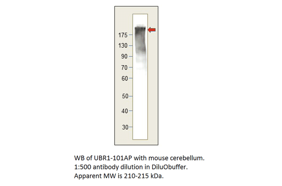 Anti-UBR1 Antibody from FabGennix (UBR1-101AP) - Antibodies.com