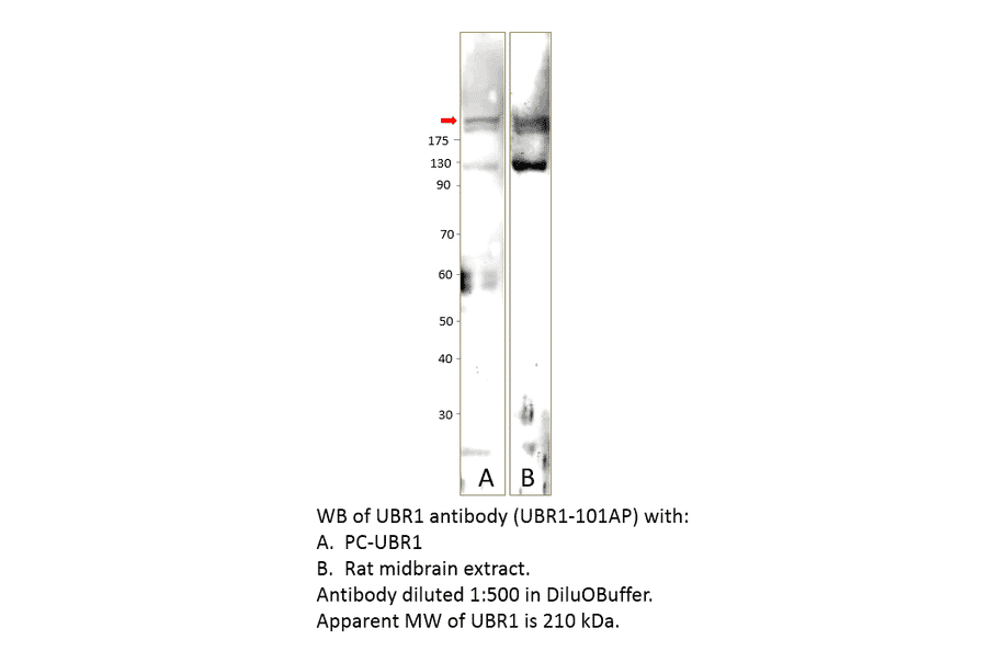 Anti-UBR1 Antibody from FabGennix (UBR1-101AP) - Antibodies.com
