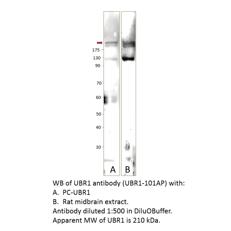 Anti-UBR1 Antibody from FabGennix (UBR1-101AP) - Antibodies.com