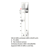 Anti-UBR1 Antibody from FabGennix (UBR1-101AP) - Antibodies.com