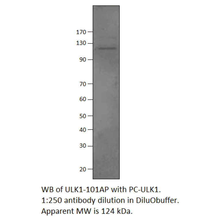 Anti-ULK1 Antibody from FabGennix (ULK1-101AP) - Antibodies.com