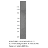 Anti-ULK1 Antibody from FabGennix (ULK1-101AP) - Antibodies.com
