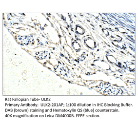 Anti-ULK2 Antibody from FabGennix (ULK2-201AP) - Antibodies.com