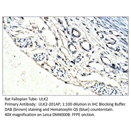 Anti-ULK2 Antibody from FabGennix (ULK2-201AP) - Antibodies.com