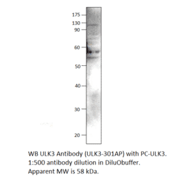 Anti-ULK3 Antibody from FabGennix (ULK3-301AP) - Antibodies.com