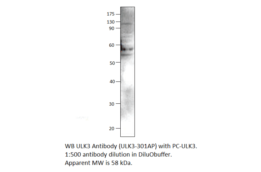 Anti-ULK3 Antibody from FabGennix (ULK3-301AP) - Antibodies.com