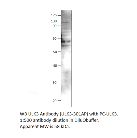 Anti-ULK3 Antibody from FabGennix (ULK3-301AP) - Antibodies.com