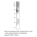 Anti-ULK3 Antibody from FabGennix (ULK3-301AP) - Antibodies.com