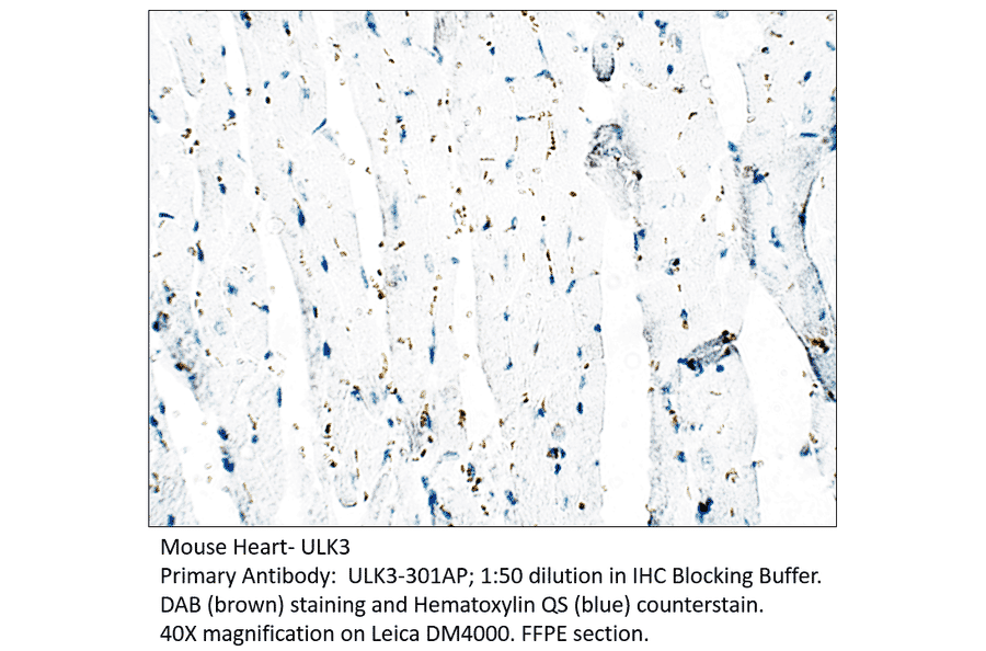 Anti-ULK3 Antibody from FabGennix (ULK3-301AP) - Antibodies.com