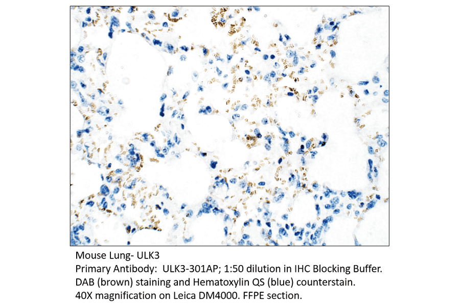 Anti-ULK3 Antibody from FabGennix (ULK3-301AP) - Antibodies.com