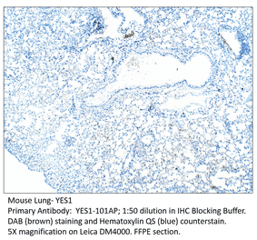 Anti-YES1 Antibody from FabGennix (YES1-101AP) - Antibodies.com