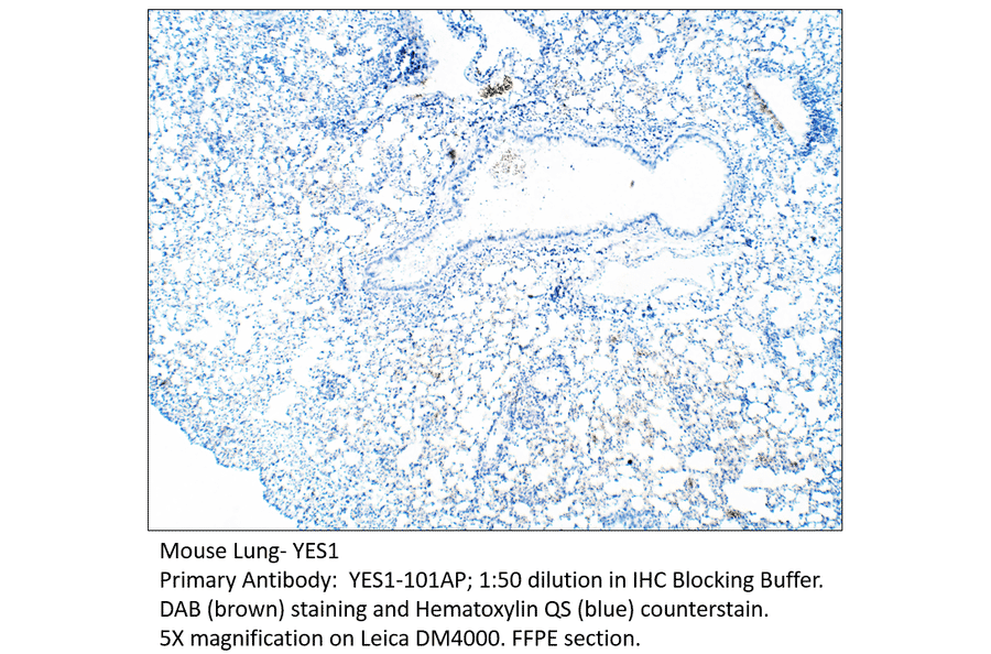 Anti-YES1 Antibody from FabGennix (YES1-101AP) - Antibodies.com