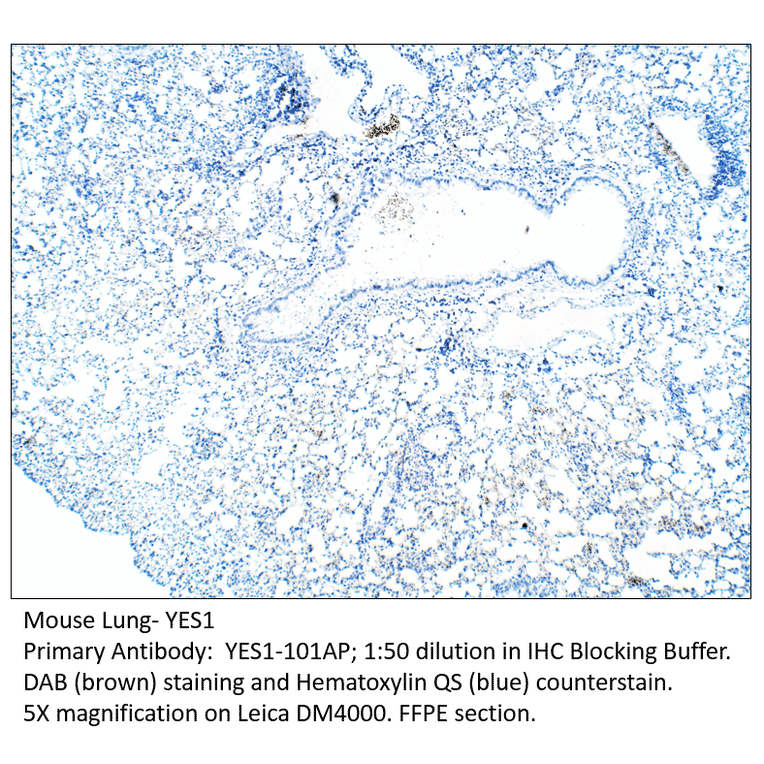 Anti-YES1 Antibody from FabGennix (YES1-101AP) - Antibodies.com