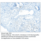 Anti-YES1 Antibody from FabGennix (YES1-101AP) - Antibodies.com