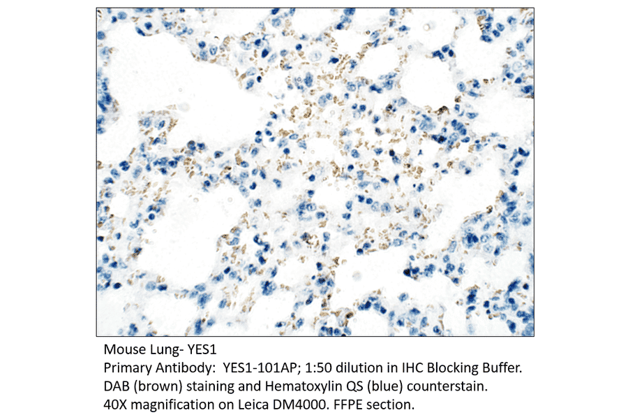 Anti-YES1 Antibody from FabGennix (YES1-101AP) - Antibodies.com