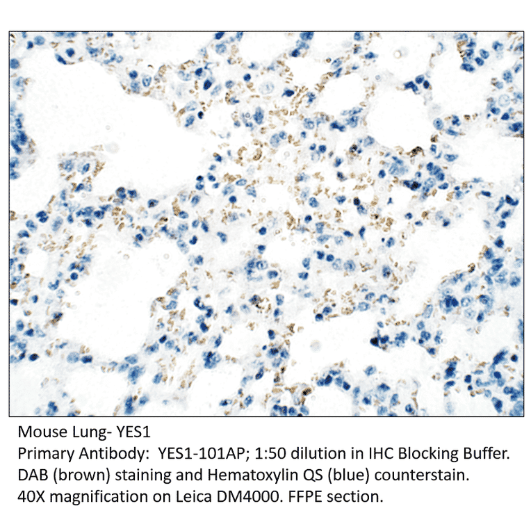 Anti-YES1 Antibody from FabGennix (YES1-101AP) - Antibodies.com