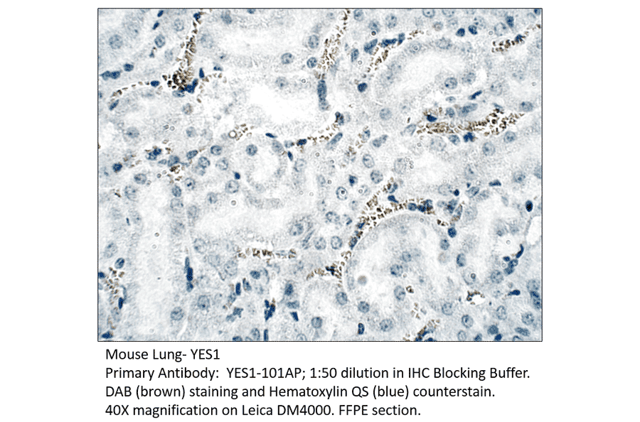 Anti-YES1 Antibody from FabGennix (YES1-101AP) - Antibodies.com