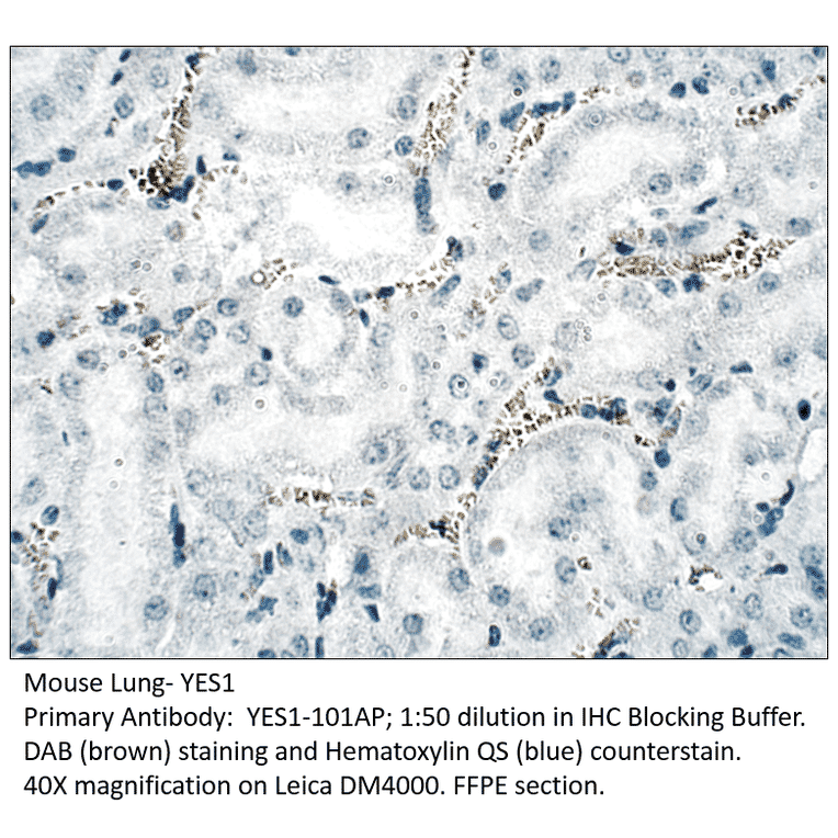 Anti-YES1 Antibody from FabGennix (YES1-101AP) - Antibodies.com