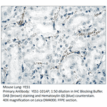 Anti-YES1 Antibody from FabGennix (YES1-101AP) - Antibodies.com