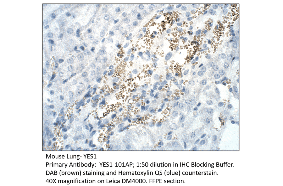 Anti-YES1 Antibody from FabGennix (YES1-101AP) - Antibodies.com