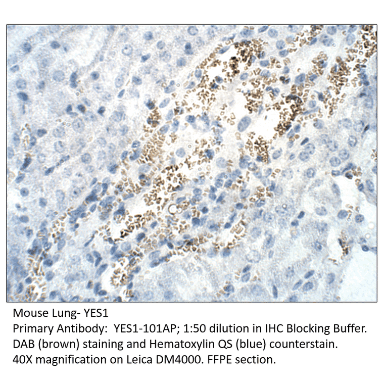 Anti-YES1 Antibody from FabGennix (YES1-101AP) - Antibodies.com