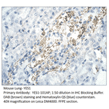 Anti-YES1 Antibody from FabGennix (YES1-101AP) - Antibodies.com