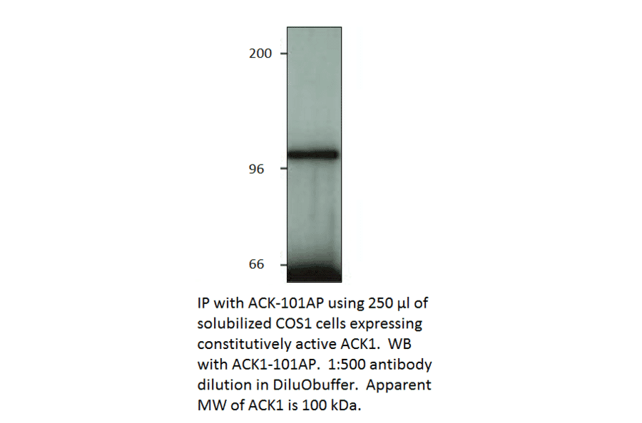 Anti-ACK1 Antibody from FabGennix (ACK-101AP) - Antibodies.com