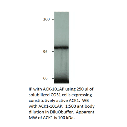 Anti-ACK1 Antibody from FabGennix (ACK-101AP) - Antibodies.com