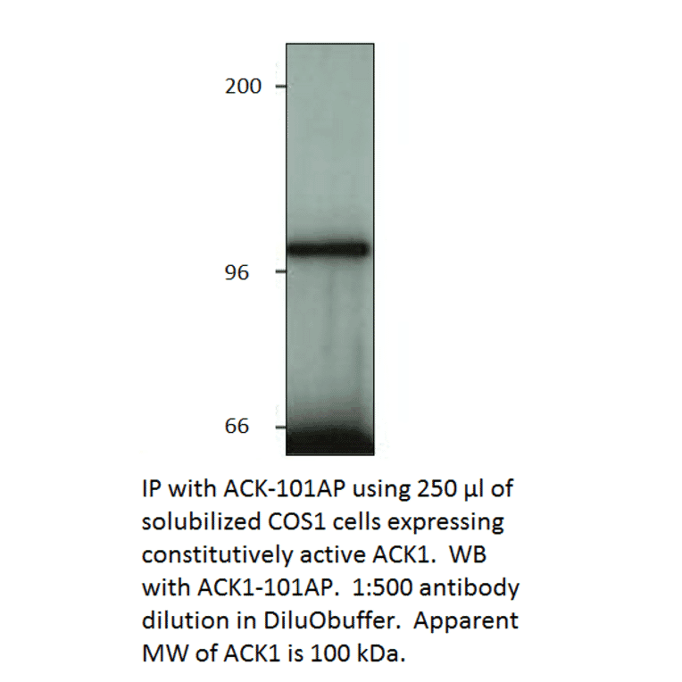 Anti-ACK1 Antibody from FabGennix (ACK-101AP) - Antibodies.com