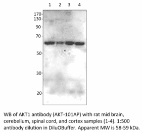 Anti-AKT1 Antibody (A55111) - Antibodies.com