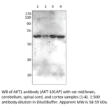 Anti-AKT1 Antibody from FabGennix (AKT-101AP) - Antibodies.com