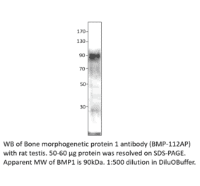 Anti-BMP1 Antibody from FabGennix (BMP-112AP) - Antibodies.com