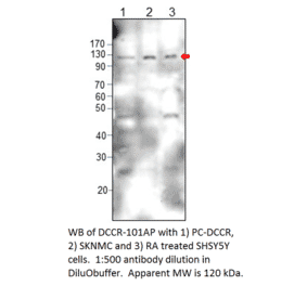 Anti-DCC Antibody from FabGennix (DCCR-101AP) - Antibodies.com