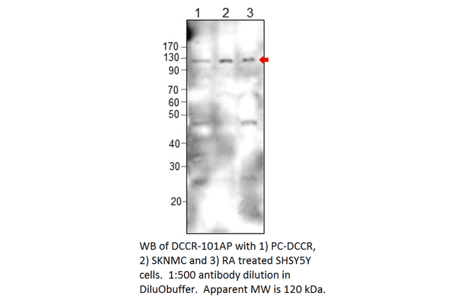 Anti-DCC Antibody from FabGennix (DCCR-101AP) - Antibodies.com