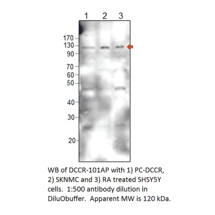 Anti-DCC Antibody from FabGennix (DCCR-101AP) - Antibodies.com