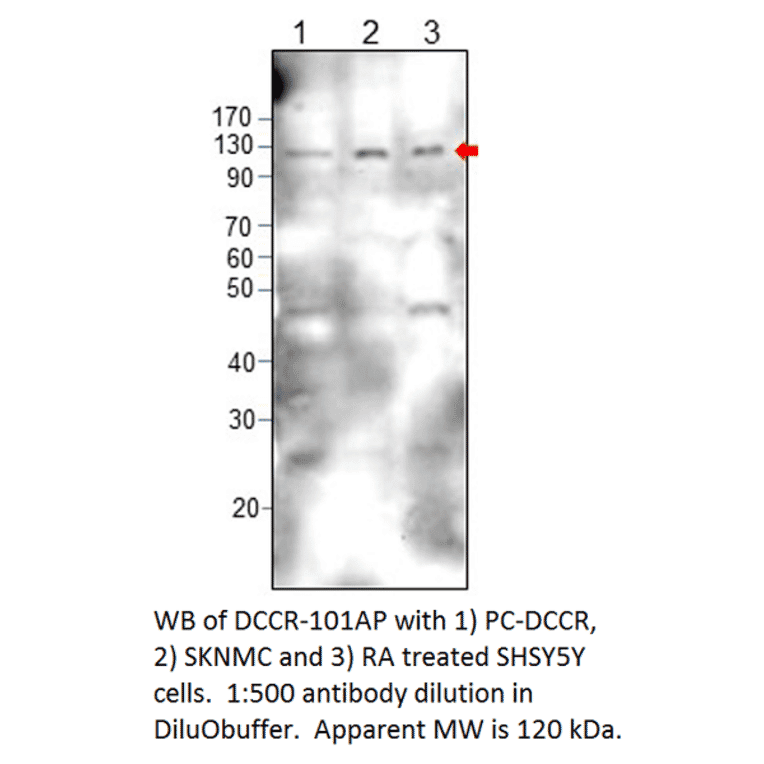 Anti-DCC Antibody from FabGennix (DCCR-101AP) - Antibodies.com