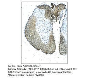 Anti-FAK1 Antibody from FabGennix (FAK1-101Y) - Antibodies.com