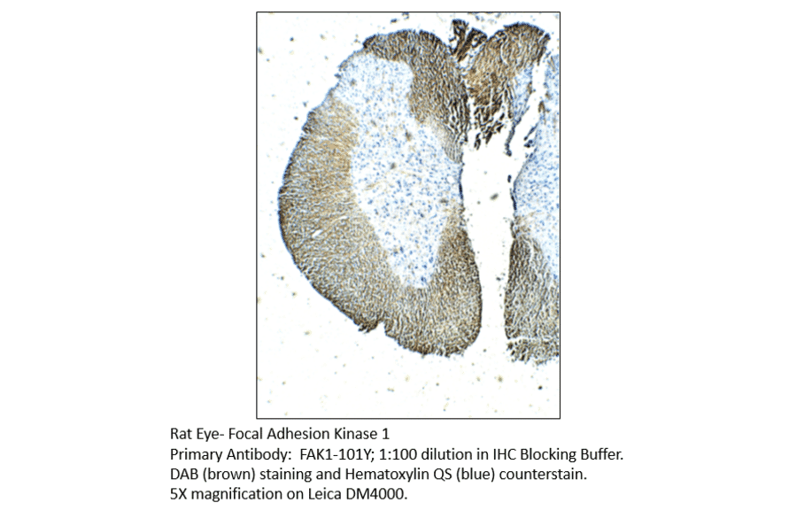 Anti-FAK1 Antibody from FabGennix (FAK1-101Y) - Antibodies.com
