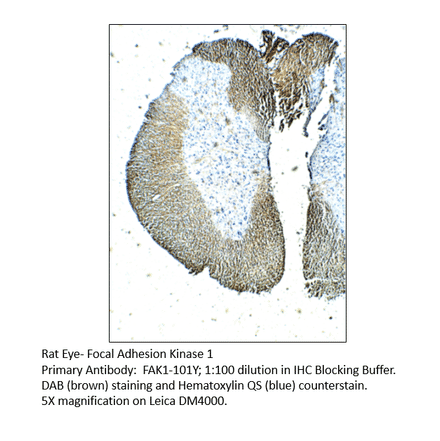 Anti-FAK1 Antibody from FabGennix (FAK1-101Y) - Antibodies.com