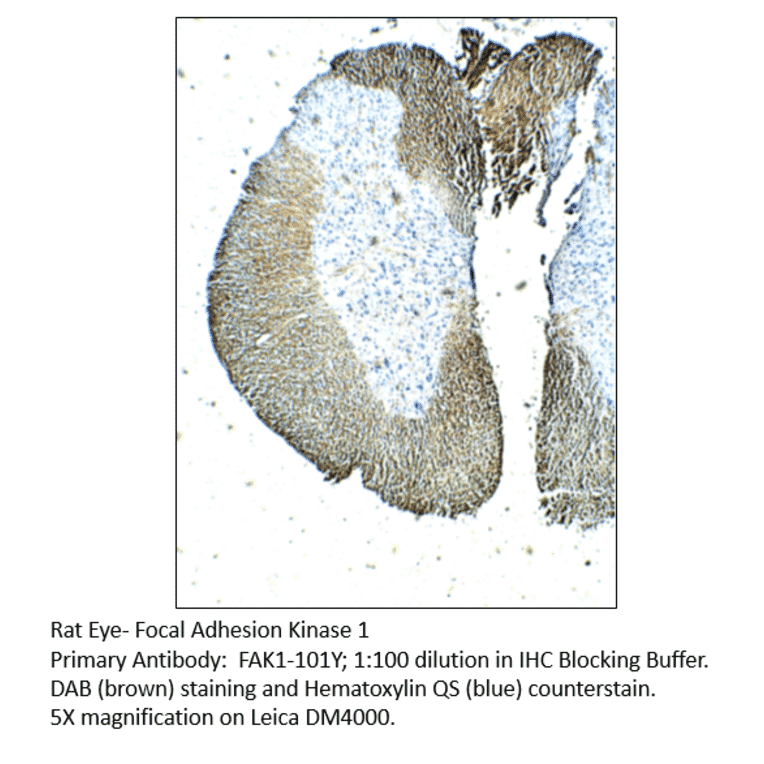 Anti-FAK1 Antibody from FabGennix (FAK1-101Y) - Antibodies.com