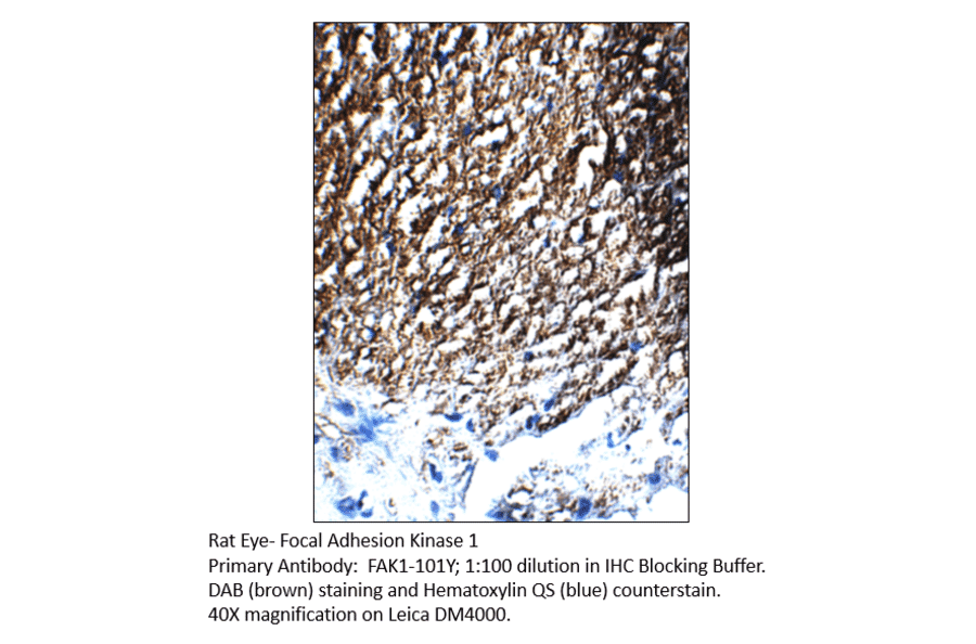 Anti-FAK1 Antibody from FabGennix (FAK1-101Y) - Antibodies.com