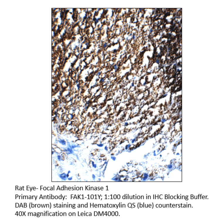 Anti-FAK1 Antibody from FabGennix (FAK1-101Y) - Antibodies.com