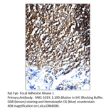 Anti-FAK1 Antibody from FabGennix (FAK1-101Y) - Antibodies.com