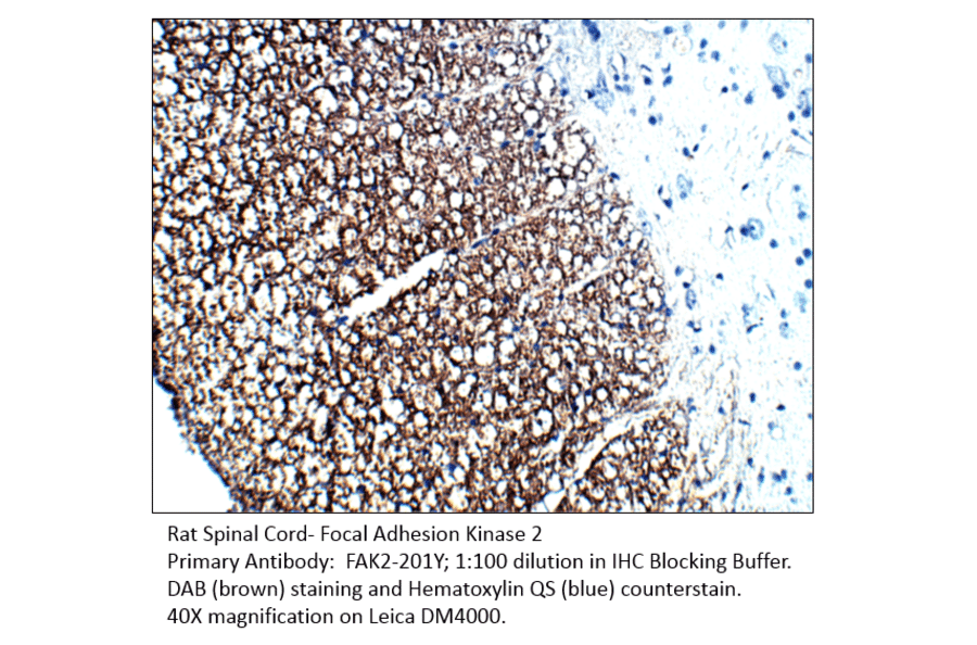 Anti-FAK2 Antibody from FabGennix (FAK2-201Y) - Antibodies.com