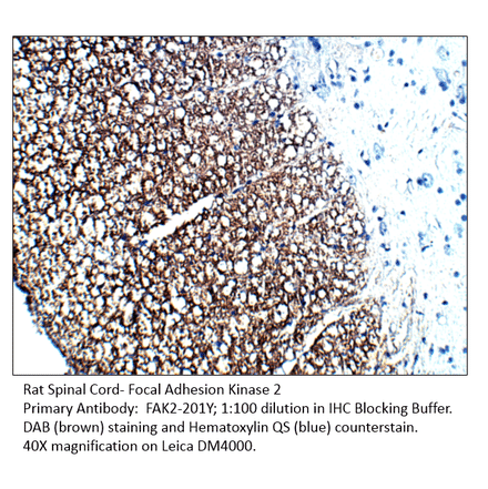 Anti-FAK2 Antibody from FabGennix (FAK2-201Y) - Antibodies.com