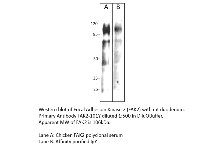 Anti-FAK2 Antibody from FabGennix (FAK2-201Y) - Antibodies.com