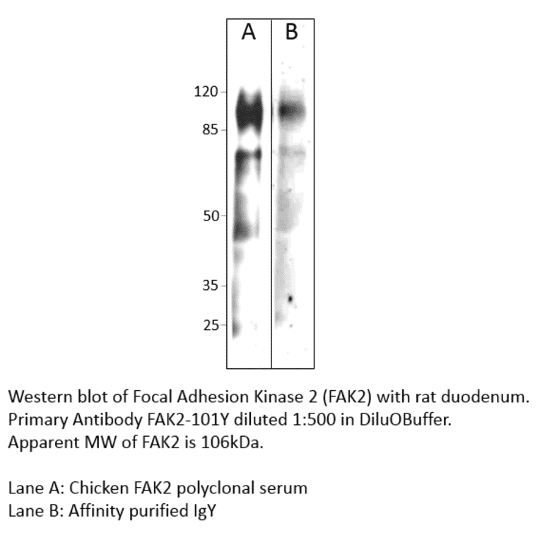 Anti-FAK2 Antibody from FabGennix (FAK2-201Y) - Antibodies.com
