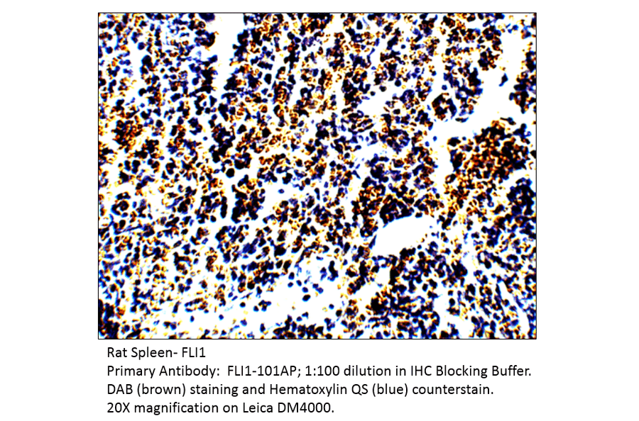Anti-FLI1 Antibody from FabGennix (FLI-101AP) - Antibodies.com